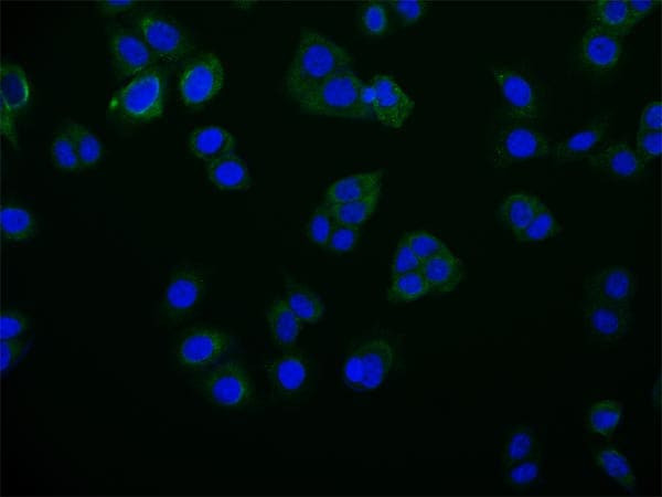 Rab25 Antibody (27H3)