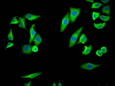 COX-2 Antibody (10B2)
