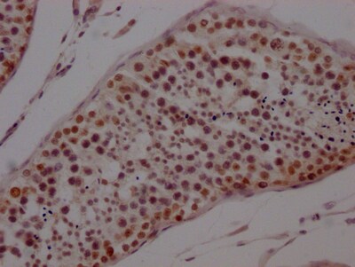 PTBP1 Antibody (8A1)