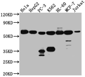 PTBP1 Antibody (8A1)