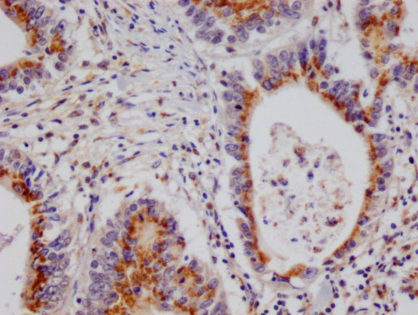 PA28 Activator alpha Subunit/PSME1 Antibody (29D5)
