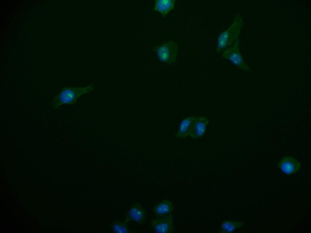 PA28 Activator alpha Subunit/PSME1 Antibody (29D5)