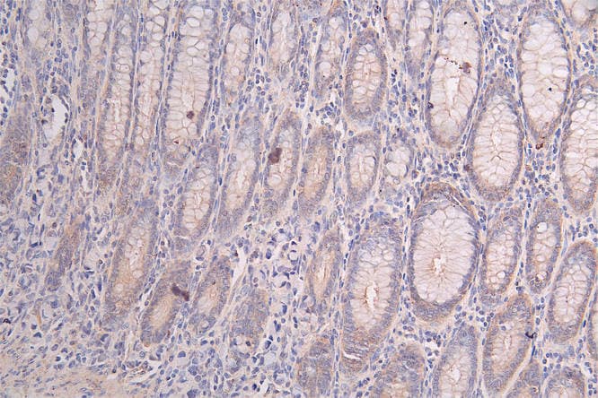 Protein Kinase A Regulatory Subunit II alpha Antibody (15G8)