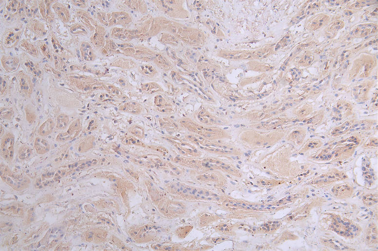 Protein Kinase A Regulatory Subunit II alpha Antibody (15G8)