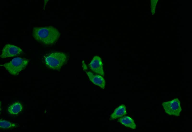 Protein Kinase A Regulatory Subunit II alpha Antibody (15G8)
