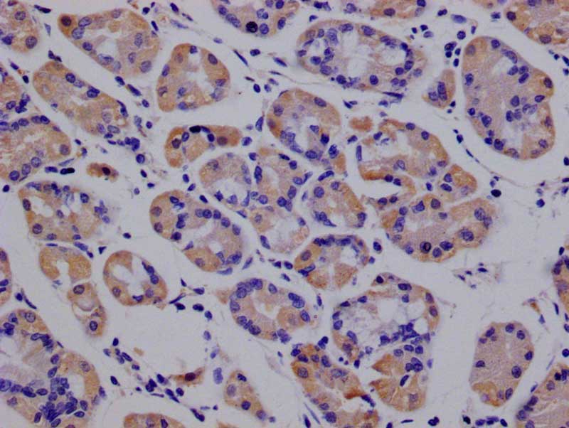 Peroxiredoxin 3 Antibody (14E2)