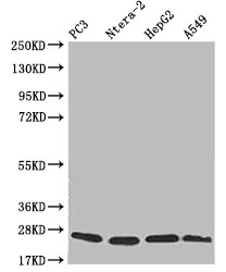 Peroxiredoxin 3 Antibody (14E2)
