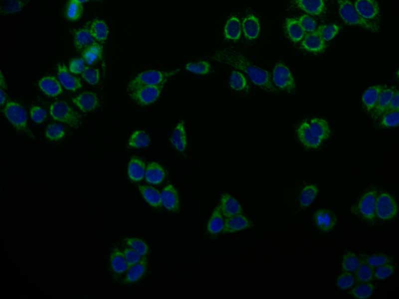 Peroxiredoxin 3 Antibody (14E2)