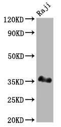 BOB1 Antibody (4A5)