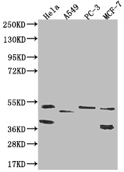 TAPP1/PLEKHA1 Antibody (16C9)