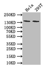 PKN2 Antibody (11H3)