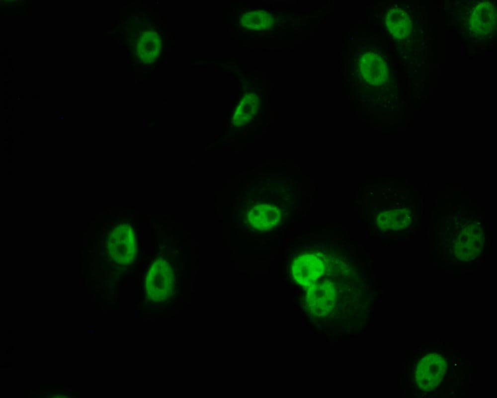 PKN2 Antibody (20A8)