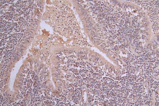 PI 3-Kinase p85 alpha Antibody (13E7)