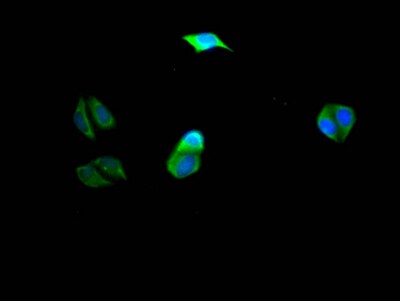 PIK3CA Antibody (10E5)