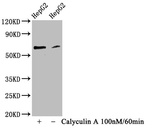 YAP1 [p Ser127] Antibody (3F3)