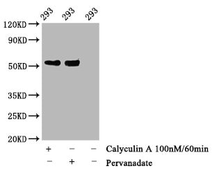p53 [p Thr55] Antibody (3C3)