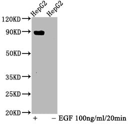 STAT5A [p Tyr694] Antibody (3F1)