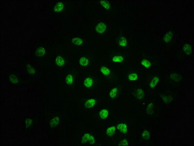 Smad2 [p Ser255] Antibody (2A12)