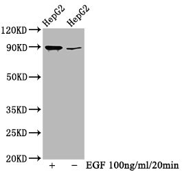 RSK1 [p Thr359, p Ser363] Antibody (1B6)