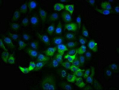 RSK1 [p Thr359, p Ser363] Antibody (1B6)