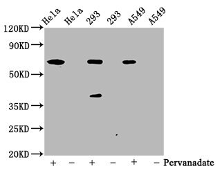 SHP-2/PTPN11 [p Tyr542] Antibody (2E2)