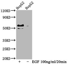 c-Myc [p Thr58, p Ser62] Antibody (4E9)