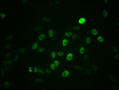 c-Myc [p Ser62] Antibody (2A10)