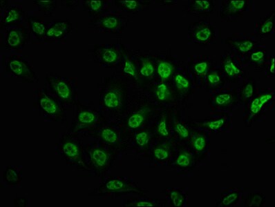 TOR/mTOR [p Ser2481] Antibody (3H11)