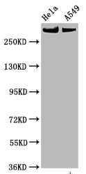 TOR/mTOR [p Ser2448] Antibody (1G6)