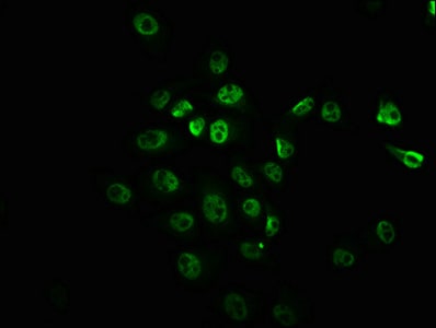 TOR/mTOR [p Ser2448] Antibody (1G6)