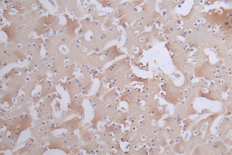 Tau [p Ser404] Antibody (11H10)