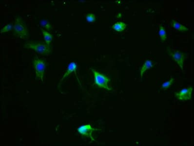 Tau [p Ser324] Antibody (4E8)
