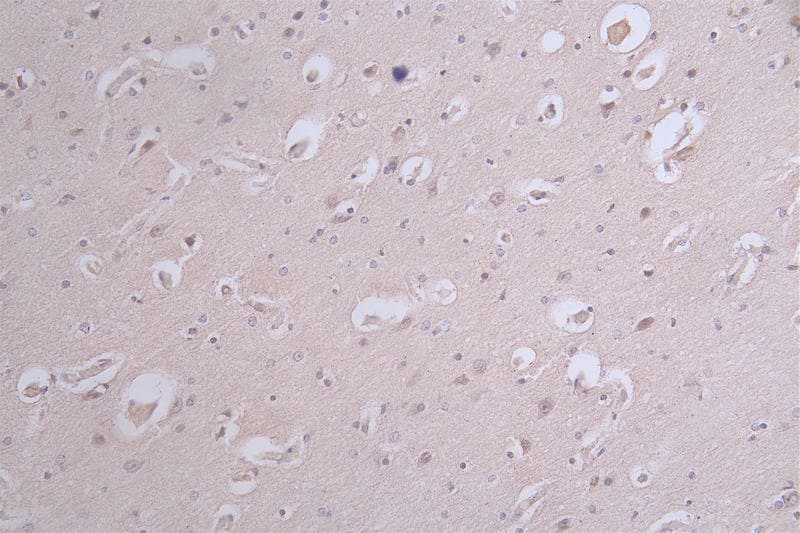 Tau [p Ser214] Antibody (31B12)