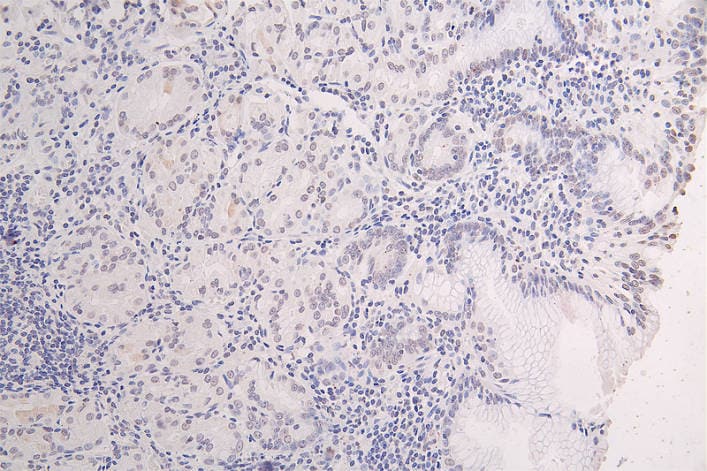 Tau [p Ser199] Antibody (23E8)
