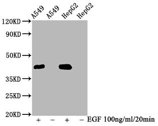 ERK1/ERK2 [p Thr202, p Thr185] Antibody (2D5)