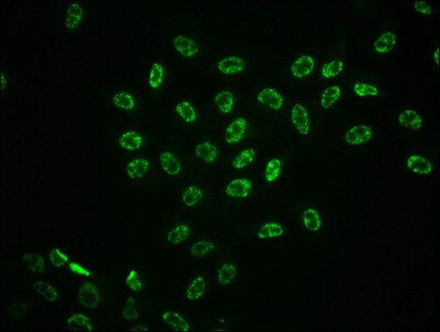 ERK1/ERK2 [p Thr202, p Thr185] Antibody (2D5)