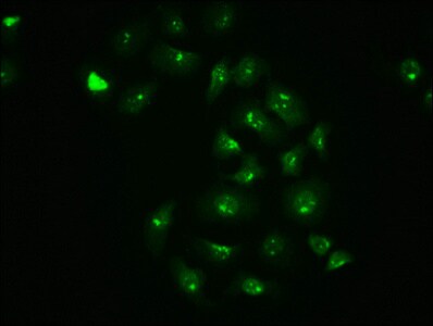 c-jun [p Ser63] Antibody (4A11)
