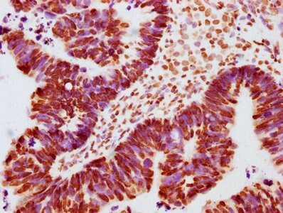Jak2 [p Tyr1007, p Tyr1008] Antibody (1A4)