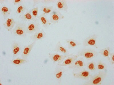 HSF1 [p Ser326] Antibody (2A7)