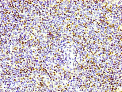 Histone H1.4 [p Thr17] Antibody (3E1)