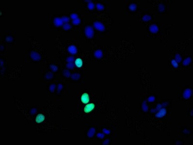 Histone H1.4 [p Thr17] Antibody (3E1)