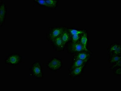 Glycogen Synthase [p Ser641] Antibody (1D1)