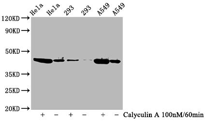 GSK-3 beta [p Ser9] Antibody (3A6)