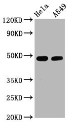 GATA-3 [p Ser308] Antibody (1E5)