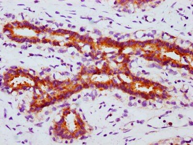 FOXO3 [p Ser253] Antibody (1E1)
