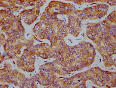 eIF2 alpha/EIF2S1 [p Ser51] Antibody (1C6)