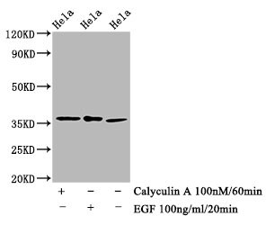 eIF2 alpha/EIF2S1 [p Ser51] Antibody (1C6)
