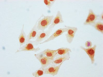 CDK2 [p Tyr15] Antibody (2C4)