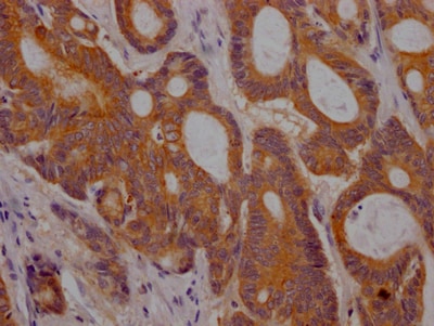 PLGF Antibody (1B6)