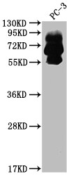 Proprotein Convertase 9/PCSK9 Antibody (7F2)